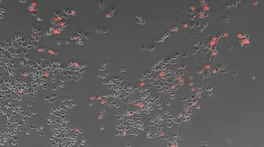 Counting cells using a phase contrast image