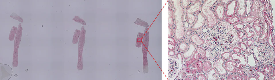 CD68（巨噬细胞）肾小球占用率的分析实例