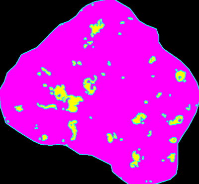 CD68（巨噬细胞）面积：998μm2